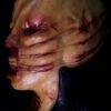 Suffering - Thumbnail Image 3
